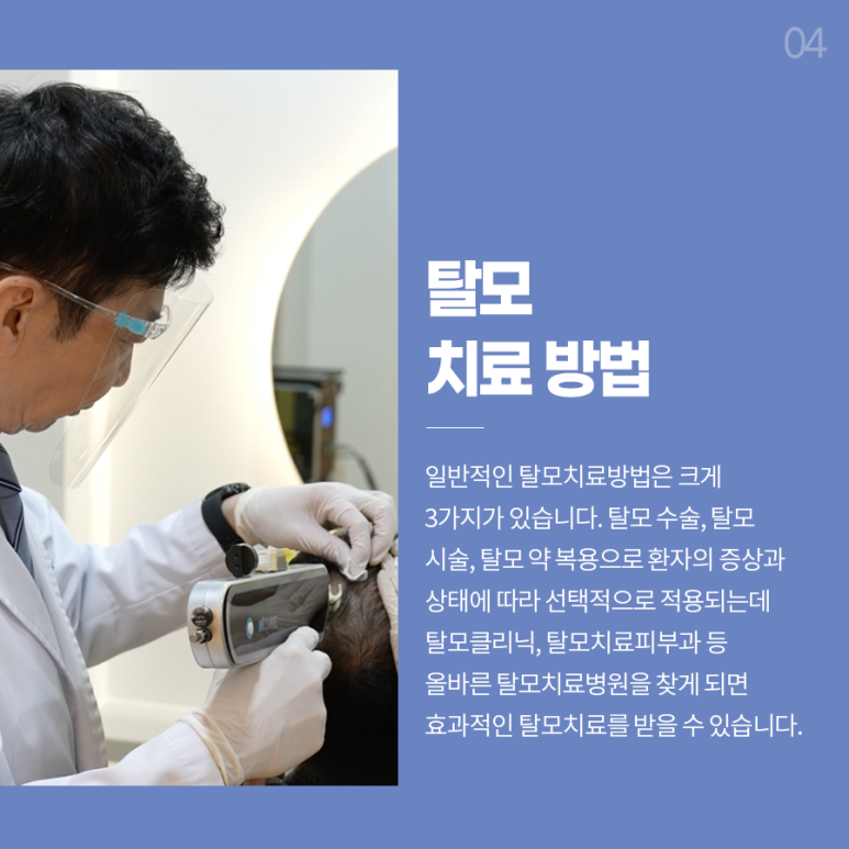 남성탈모치료 좋은 선택지가 될 수 있습니다. 관련 이미지 6