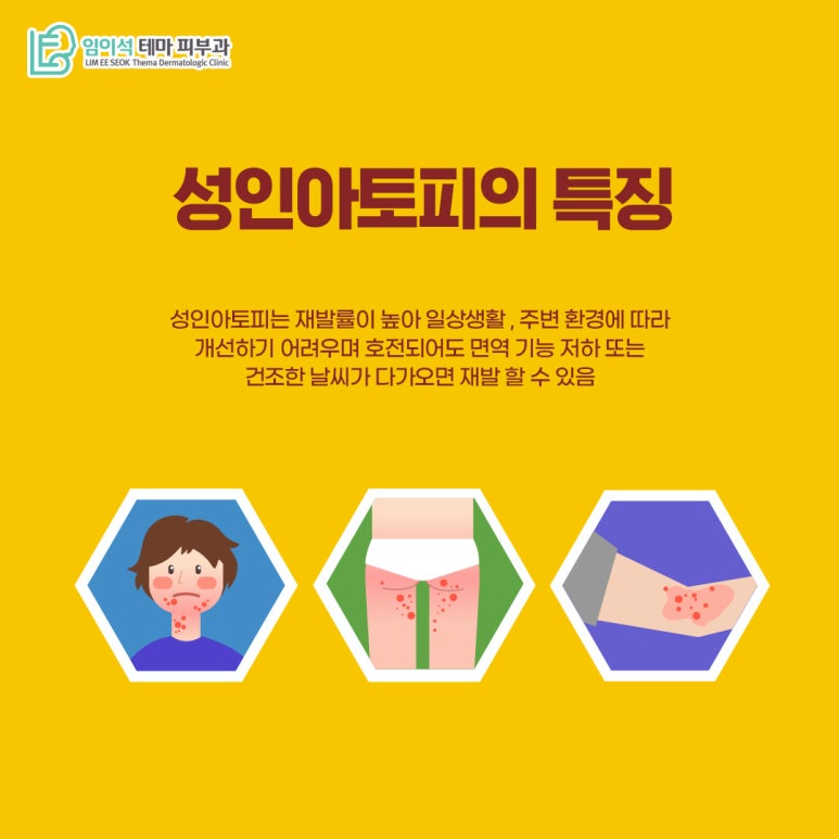임이석피부과 성인아토피 피부염의 발병 원인과 치료법 관련 이미지 8