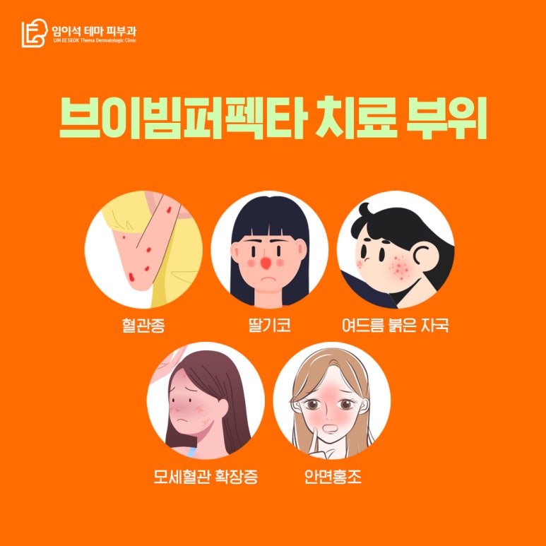 신사피부과 안면홍조 치료 전문 레이저, 브이빔 퍼펙타 관련 이미지 4