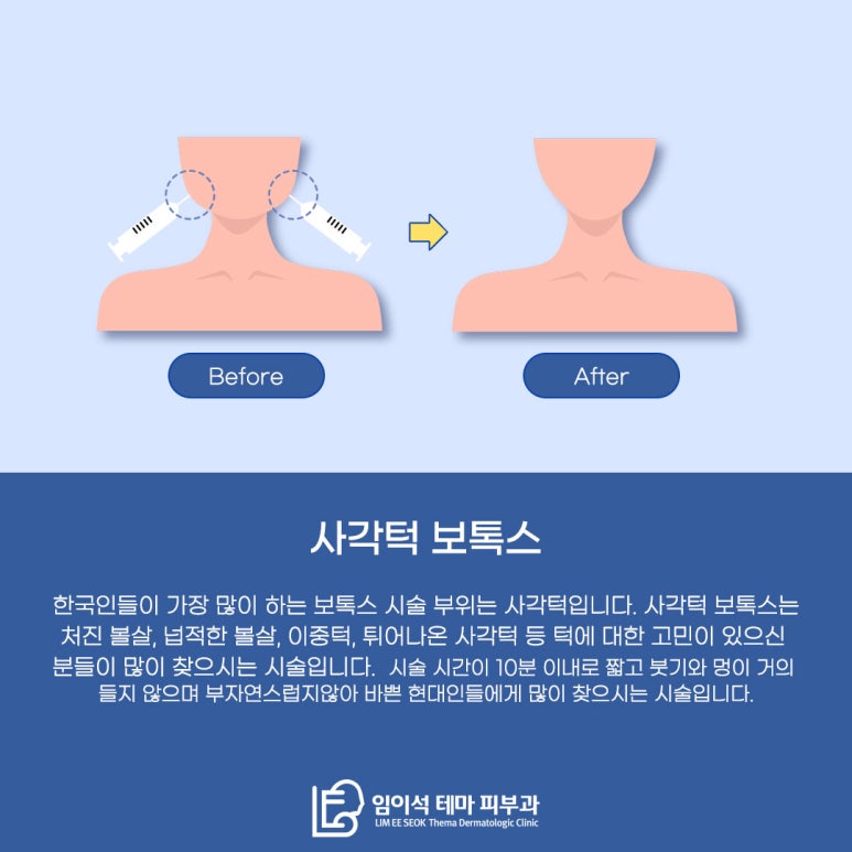임이석테마피부과에서 알려드리는 턱 보톡스 관련 이미지 4