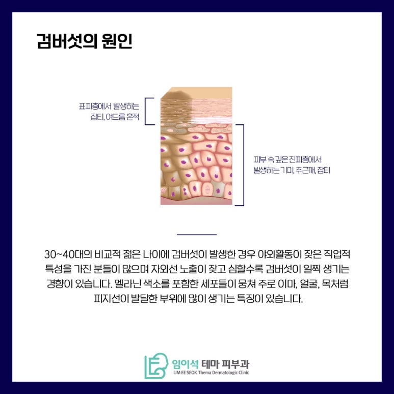 Treatment and Management Methods for Age Spots by Imiseok Thema Dermatology image 3