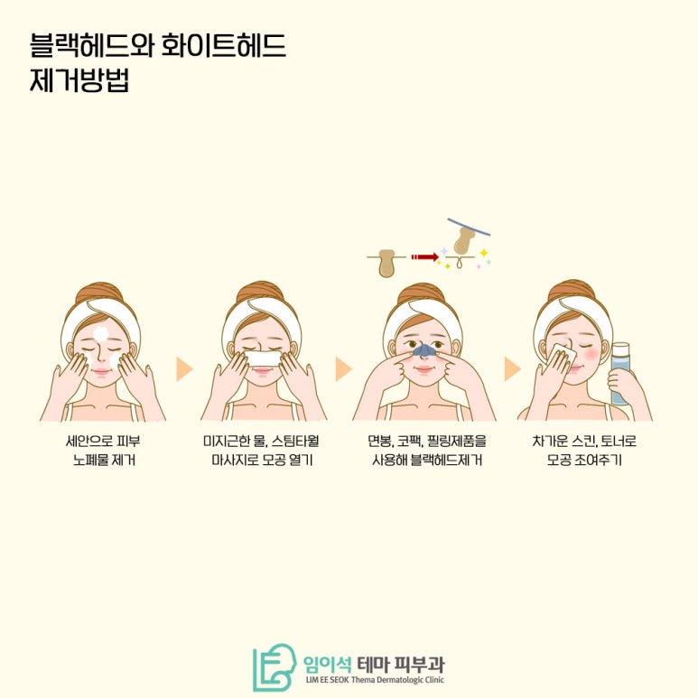 임이석테마피부과에서 알려드리는 블랙헤드와 화이트헤드 관리법 관련 이미지 4