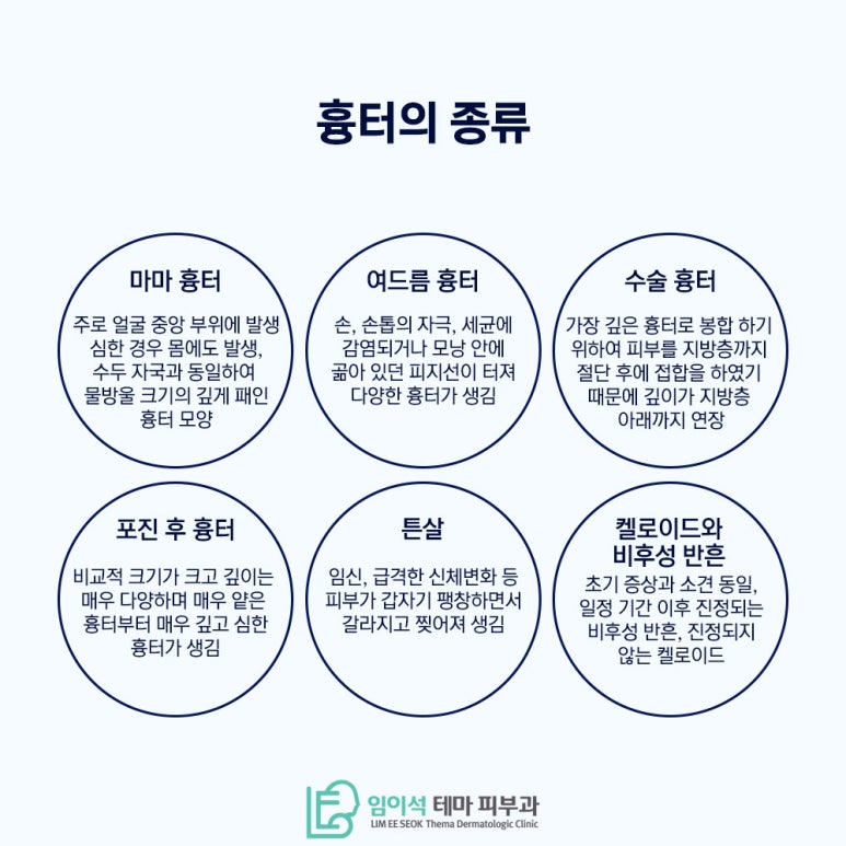 레이저를 활용한 다양한 흉터 제거 방법 관련 이미지 4