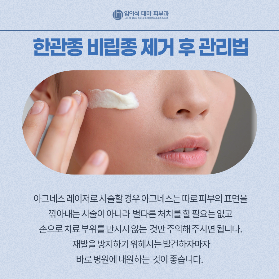 Differences Between Syringoma and Milia and How to Treat Them image 8