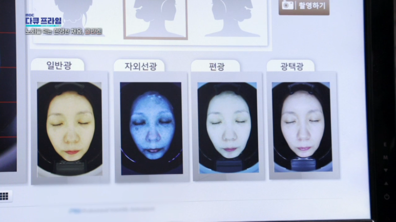 임이석 원장 "노화를 막는 현명한 채움 콜라겐" MBC 다큐프라임 출연 관련 이미지 2
