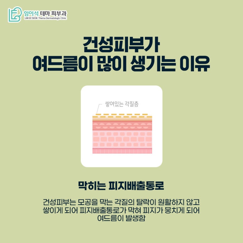 임이석테마피부과 피부 타입별 여드름관리법 <건성피부편> 관련 이미지 3