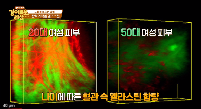 Director Im E-seok: “Elasticity That Protects Overall Health! Elastin” Appearance on OBS Amazing World image 4