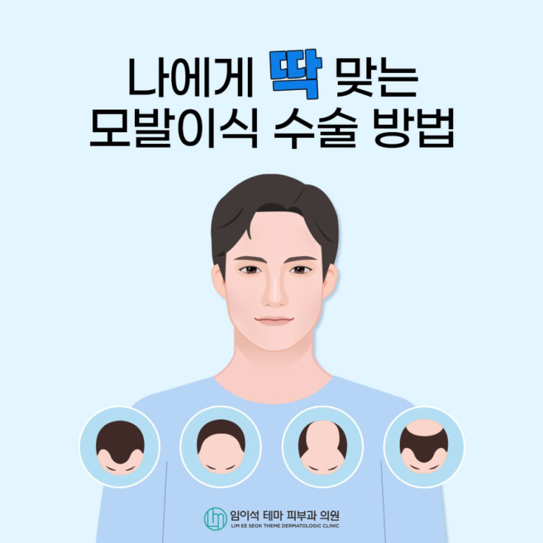 모발이식, 나에게 맞는 수술 찾는 방법 관련 이미지 2