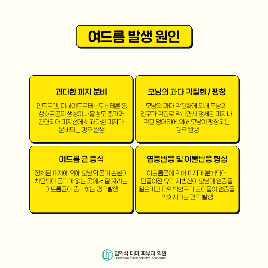 여드름의 종류, 원인, 치료, 흉터 관리법 관련 이미지 3