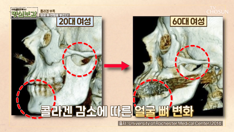 임이석 원장 "건강 악화의 신호, 피부 노화" TV조선 명심보감 출연 관련 이미지 6