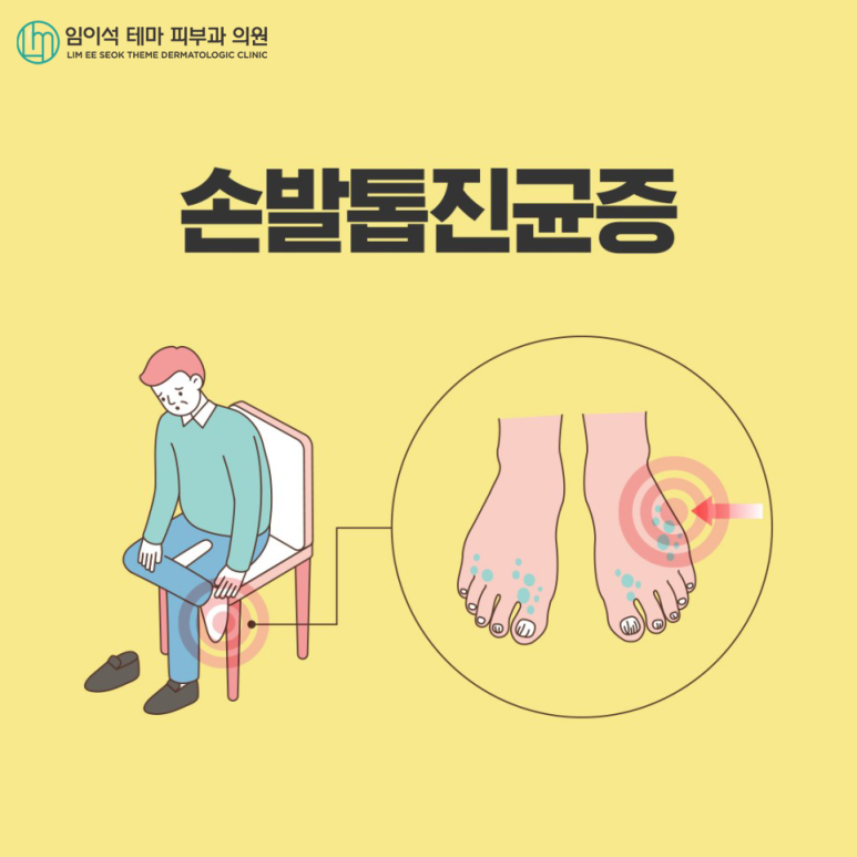 손발톱진균증, 효과적인 치료법은? 관련 이미지 2