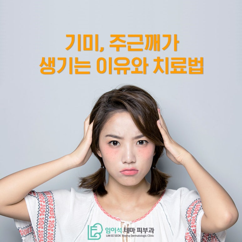 Reasons Melasma and Freckles Develop, and How They Are Treated, as Explained by Imiseok Thema Dermatology image 2