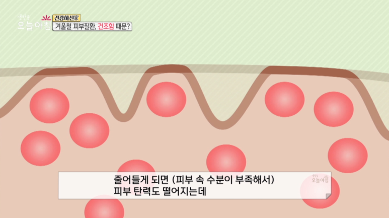 Director Im E-seok: “Winter Skin Conditions, Because of Dryness?” Appearances on MBC Live Morning Today image 8