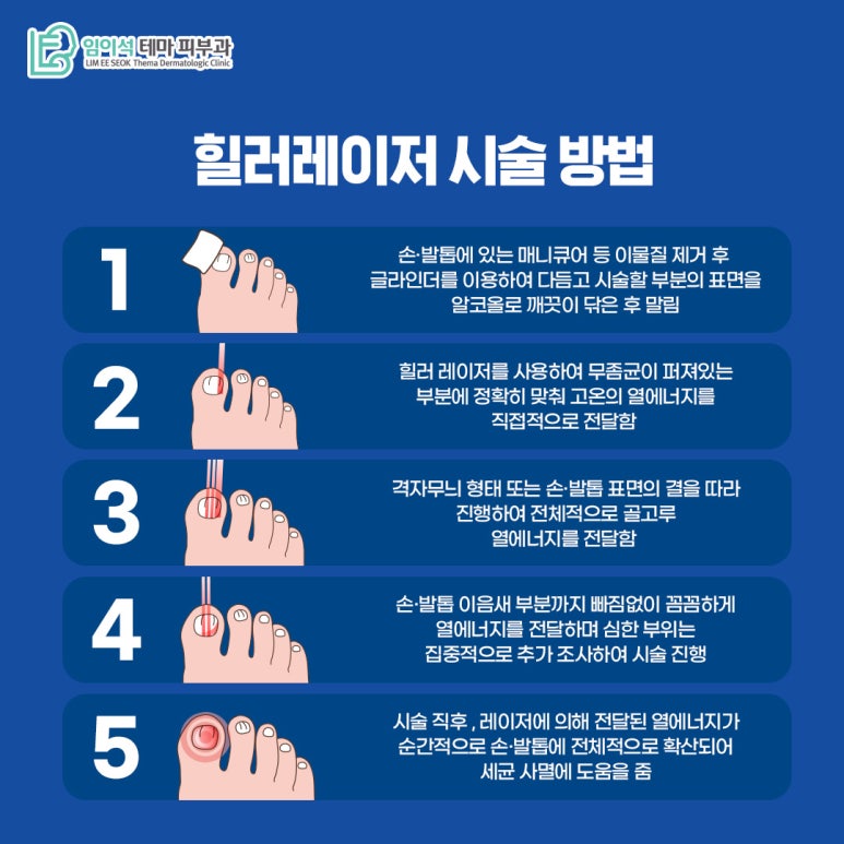 임이석 피부과 손발톱진균증 치료 레이저 힐러1064 관련 이미지 6