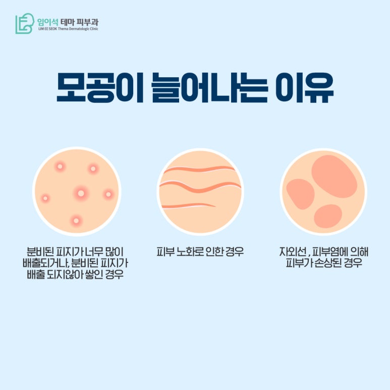 강남 피부과 늘어난 모공 줄이는 방법 관련 이미지 3