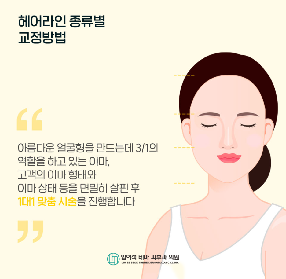 헤어라인 교정 방법은 무엇이 있을까요? 관련 이미지 5