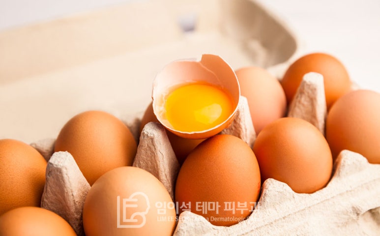 탈모에 좋은 음식 - 탈모예방 임이석피부과 관련 이미지 3