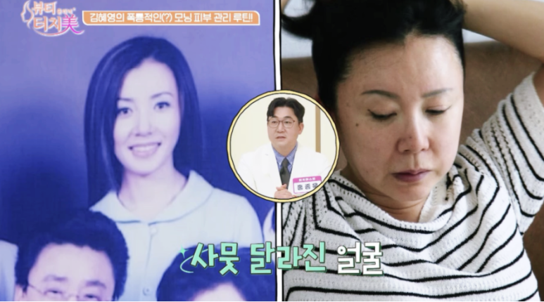 채널A 뷰티클리닉 터치미 9회~11회 사례로 알아보는 피부를 망치는 습관 모음집 [신사역 임이석테마피부과] 관련 이미지 5