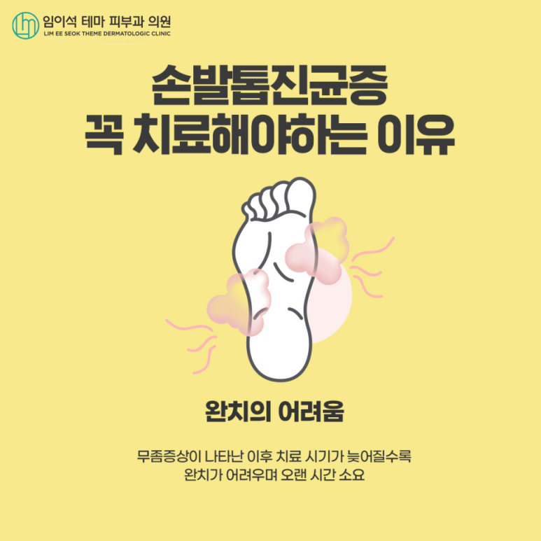 Nail Fungus: What Is the Most Effective Treatment? image 7