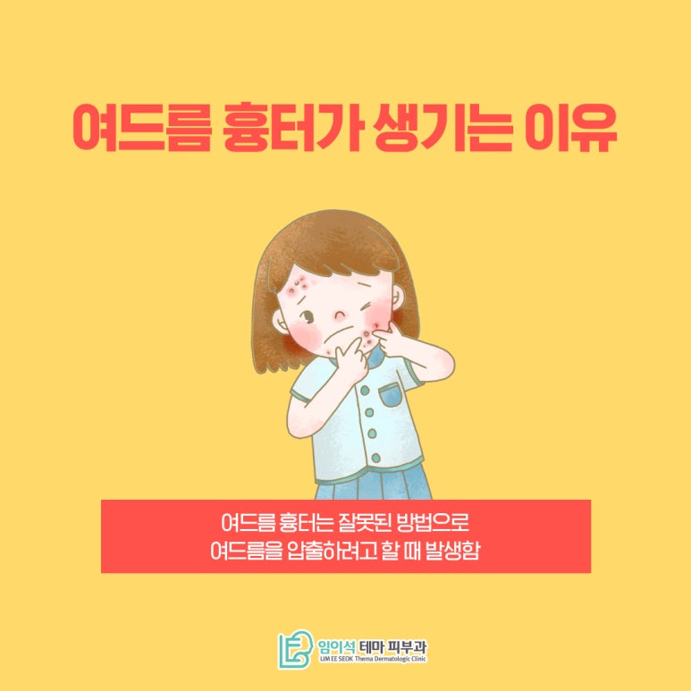 피부에 울퉁불퉁하게 생기는 여드름흉터 치료방법 관련 이미지 4