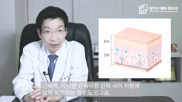 [Imiseok Thema Dermatology YouTube Dr. Imiseok Channel] Effective Cosmetic Procedure Botox: Where in the Skin Layers Should It Be Injected? image 14