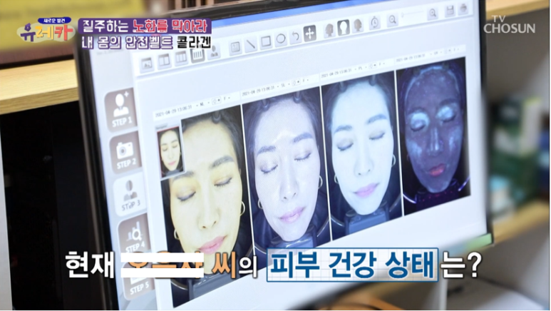 강남피부과전문의 임이석원장, "동안의 주인공 과연 피부나이 측정 결과는?"- TV CHOSUN [새로운 발견 유레카] 출연 관련 이미지 1
