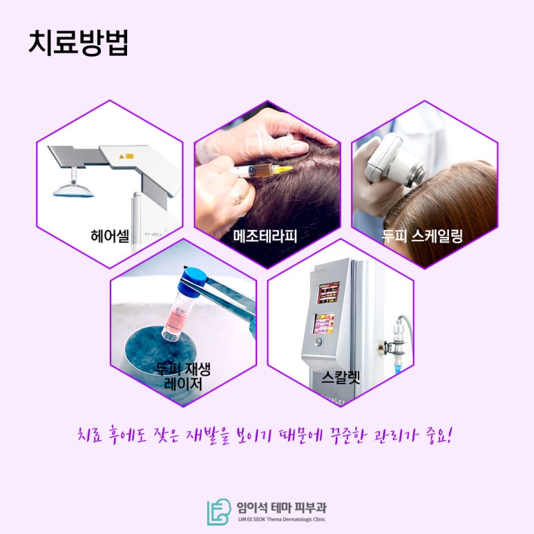 [임이석테마피부과] 지루성 두피염 방치하면 지루성 탈모된다!? 관련 이미지 7