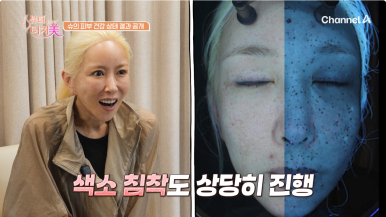 S.E.S 슈의 피부 고민, 임이석 대표 원장이 제안한 맞춤 솔루션 3가지 (채널A 뷰티클리닉 터치미 4화) 관련 이미지 5