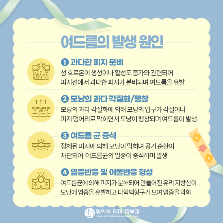 여드름의 종류, 원인, 치료, 흉터 관리법 관련 이미지 3