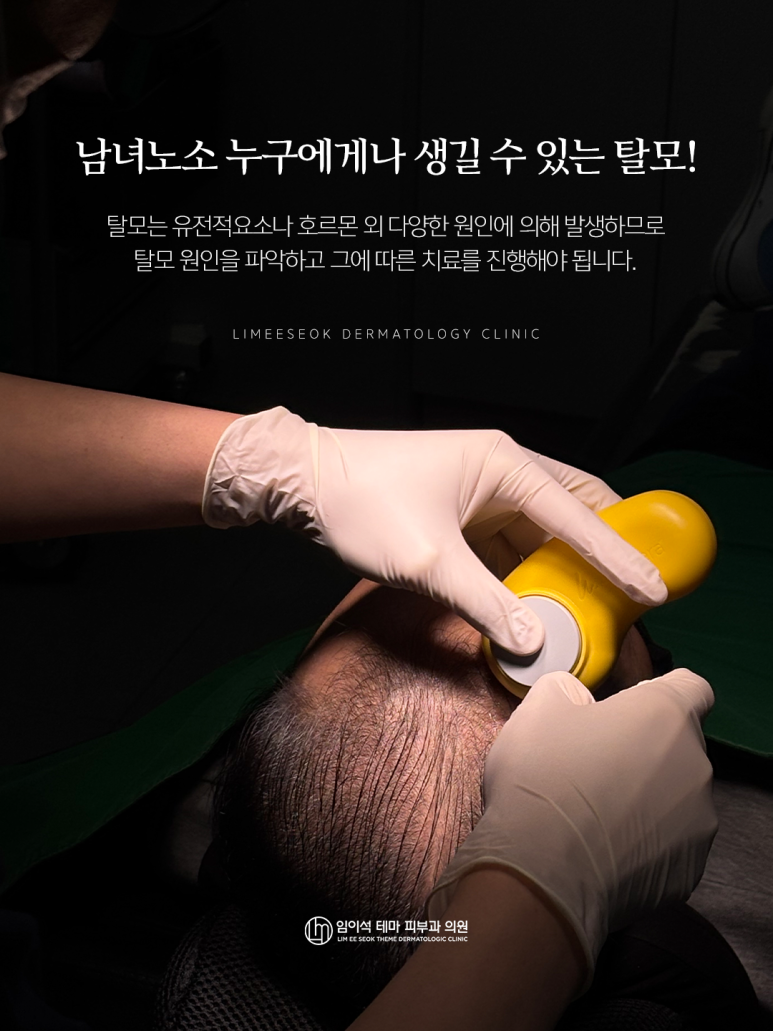 Sinsa Station Hair Loss Treatment, the Scalp Is Skin Too! Treatment Should Be by a Dermatology Specialist image 4