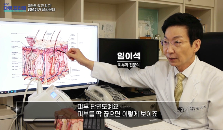 Director Im Eiseok: “With and without collagen! Menopause changes” Appears on MBC DocuPrime image 4