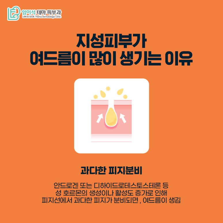 임이석테마피부과 피부 타입별 여드름관리법 <지성피부편> 관련 이미지 3