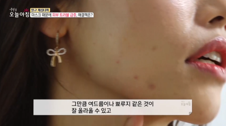 피부과 전문의 임이석원장, "마스크때문에 트러블 급증, 해결책은?" MBC <생방송 오늘 아침> 출연 관련 이미지 4