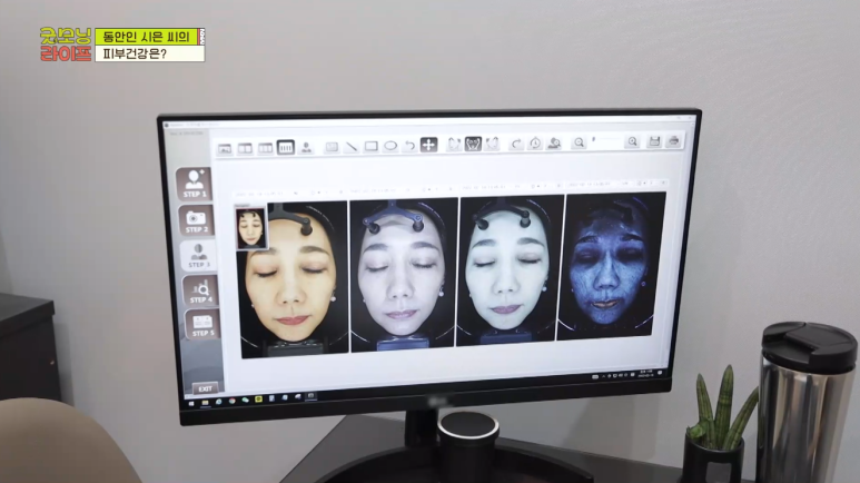 임이석테마피부과, 임이석 원장 JTBC 굿모닝라이프 출연 관련 이미지 2