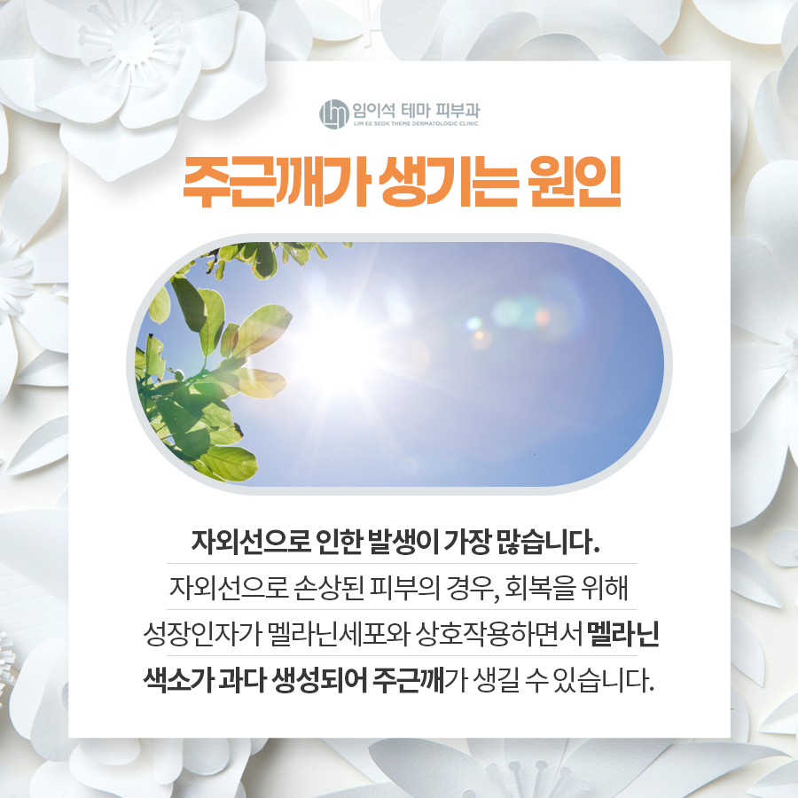 주근깨 개선을 위한 치료법 관련 이미지 4