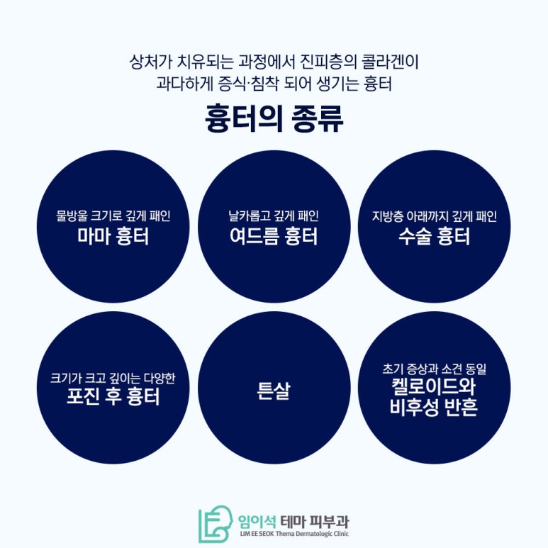 레이저를 활용한 다양한 흉터 제거 방법 관련 이미지 3