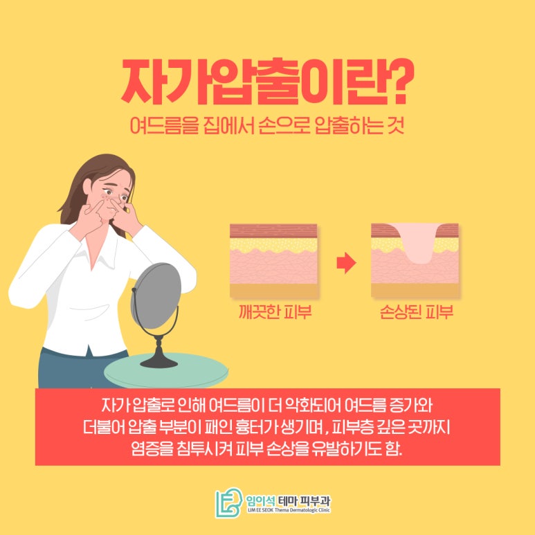 피부에 울퉁불퉁하게 생기는 여드름흉터 치료방법 관련 이미지 5