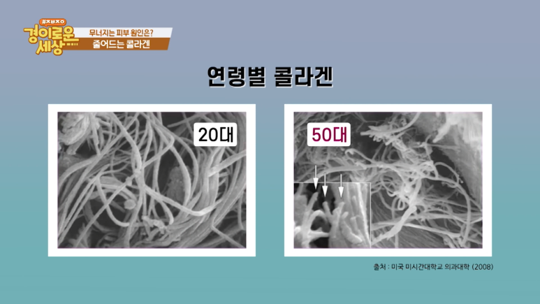 강남 피부과전문의 임이석, OBS [경이로운세상] 방송출연 관련 이미지 5