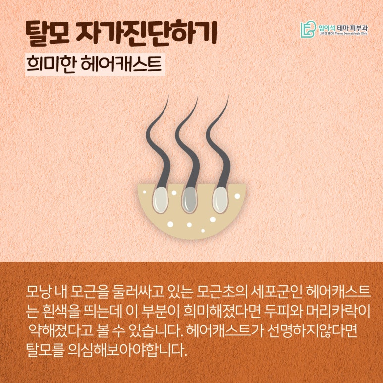 혹시, 나도 탈모일까? 신사피부과 탈모자가진단법 관련 이미지 4