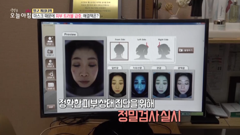 피부과 전문의 임이석원장, "마스크때문에 트러블 급증, 해결책은?" MBC <생방송 오늘 아침> 출연 관련 이미지 1