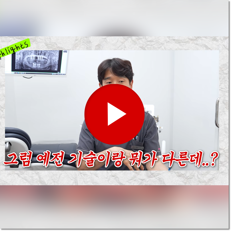 무치악 임플란트 개수와 가격만 보고 고르면 후회하는 4가지 이유 관련 이미지 2