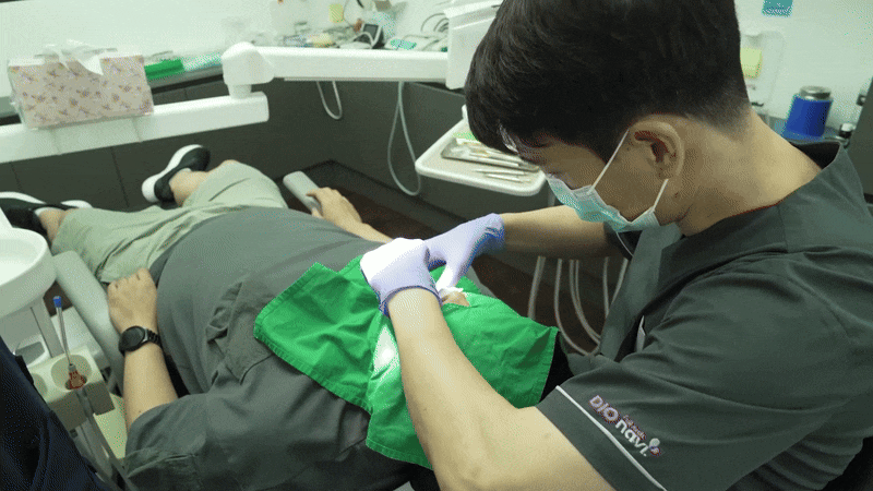 Front Tooth Implant Temporary Tooth: It Is Definitely Necessary image 3