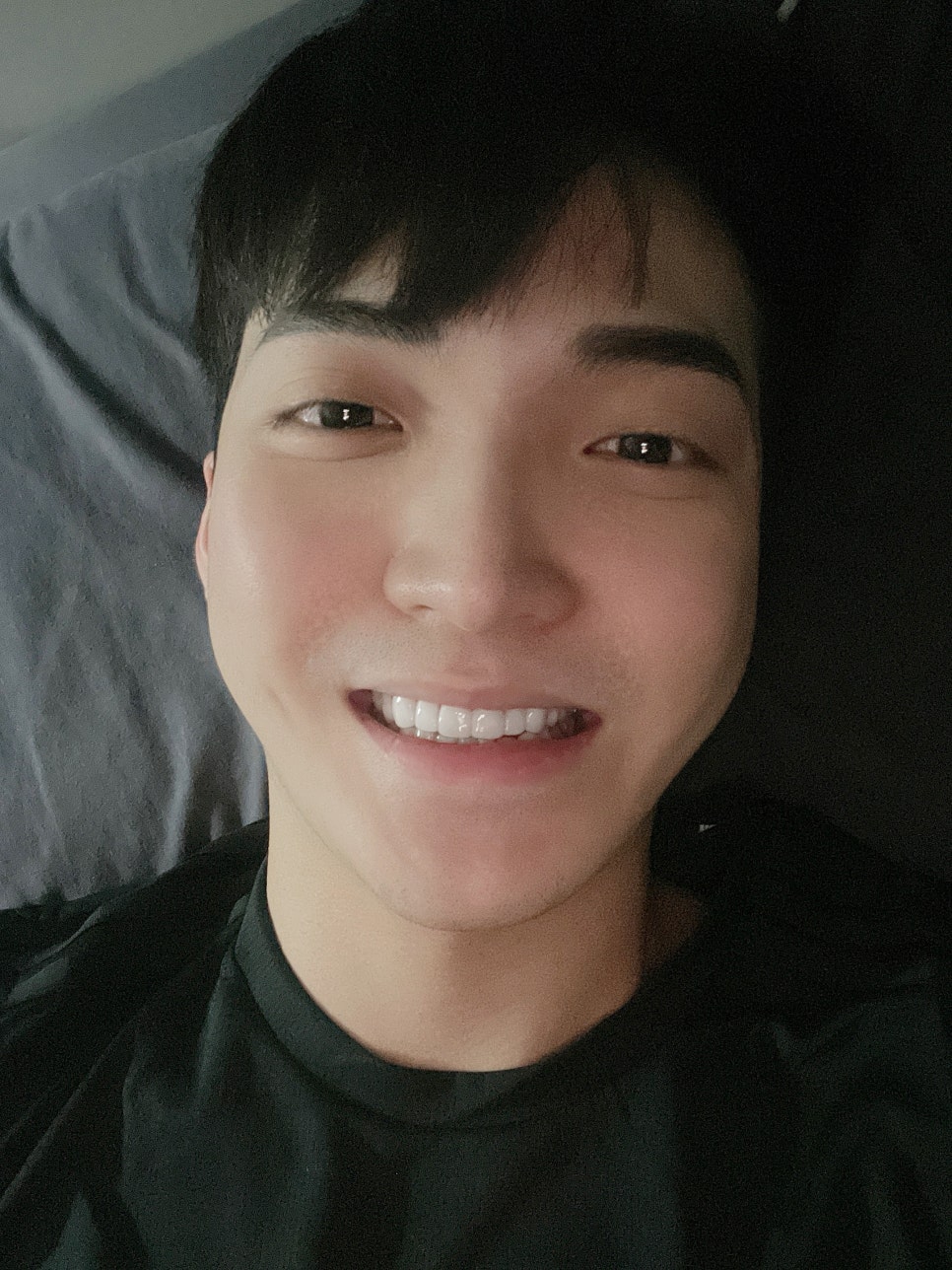 치아라미네이트 과정 후기 알아보자 관련 이미지 6