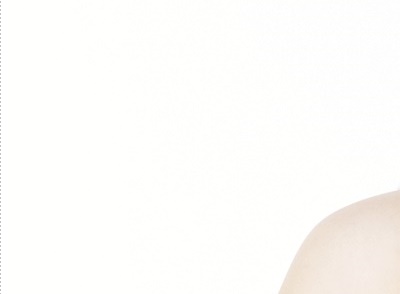 압구정로데오 임플란트 탄탄한 치아 유지는? 관련 이미지 21