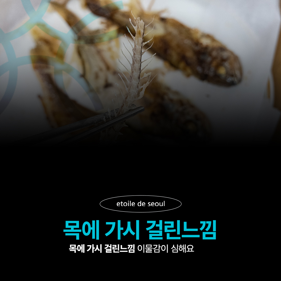 목에 가시 걸린느낌 이물감이 심해요 관련 이미지 1