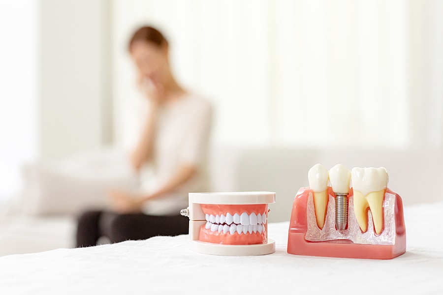 청담동임플란트 식립 방식의 차이 관련 이미지 7