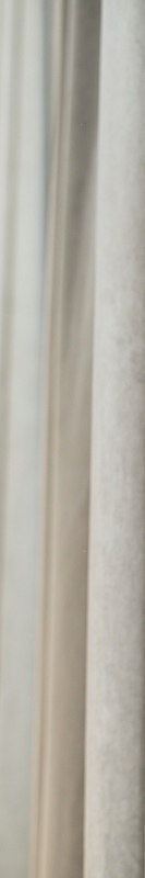 전체임플란트 임시치아 자연스러운 곳 관련 이미지 37