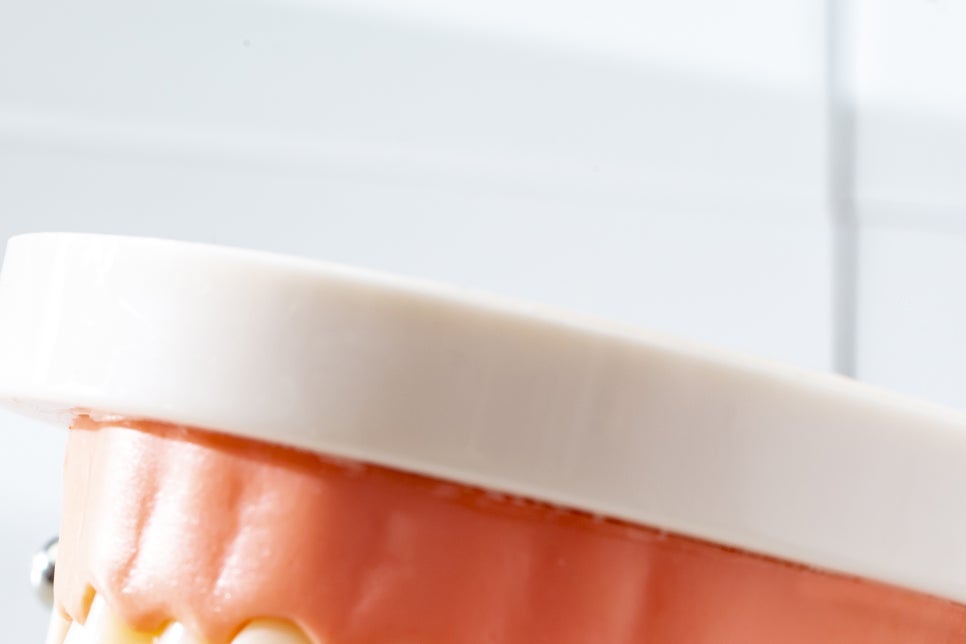 강남 어금니 임플란트 고려가 필요한 4가지! 관련 이미지 10