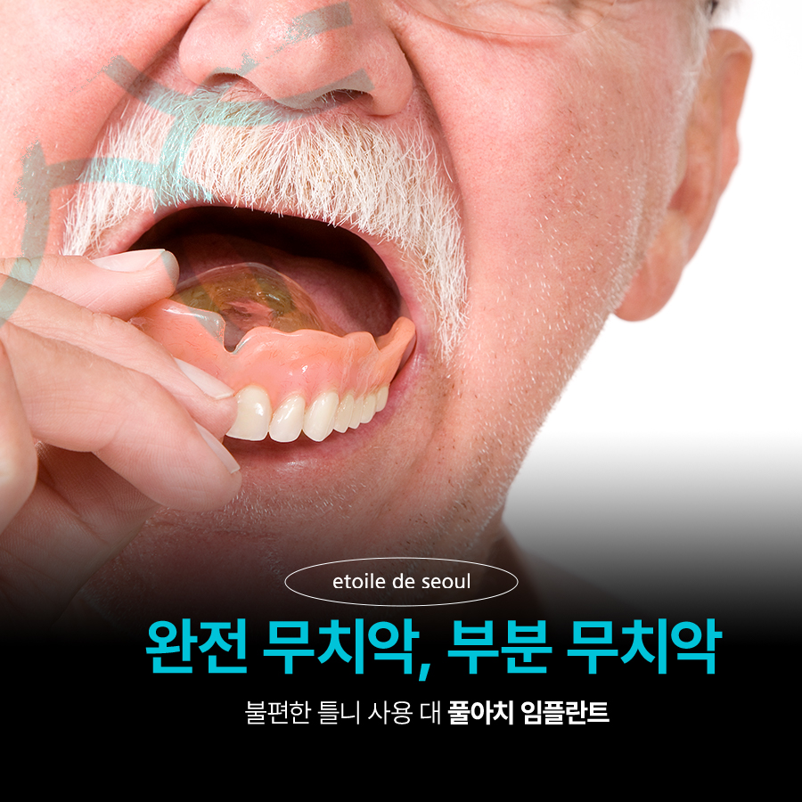 학동사거리치과 무치악 어르신들이라면? 관련 이미지 3