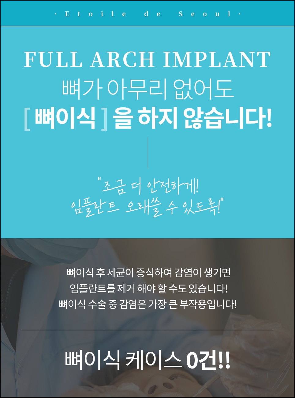 압구정 치과 임플란트 가격만 보고 고르면 손해 보는 3가지 이유 관련 이미지 16
